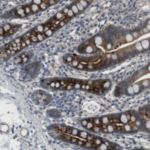 Anti-ABHD15 antibody produced in rabbit 