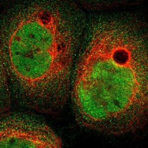 Anti-ABHD15 antibody produced in rabbit 