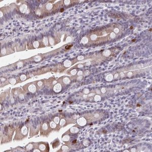 Anti-ABHD16B antibody produced in rabbit 