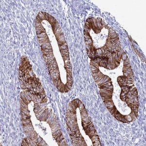 Anti-ABHD17B antibody produced in rabbit 