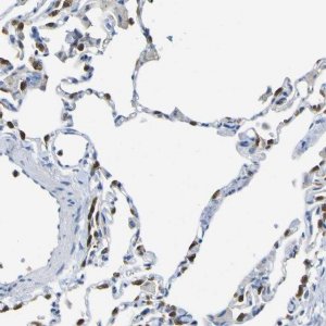 Anti-ABHD3 antibody produced in rabbit HPA010729-100UL