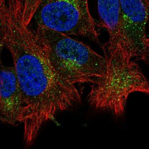 Anti-ABHD6 antibody produced in rabbit 