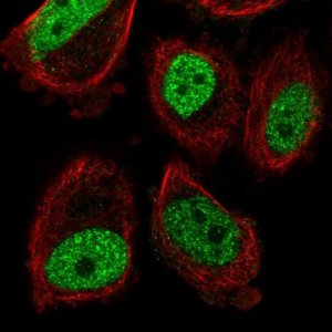 Anti-ABHD8 antibody produced in rabbit 