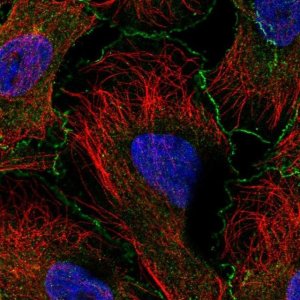 Anti-ABI1 antibody produced in rabbit 