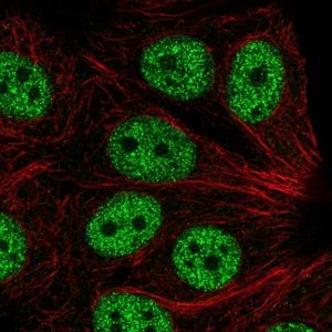 Anti-ABI2 antibody produced in rabbit 