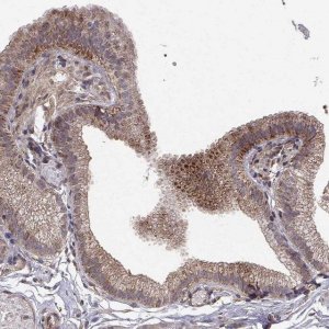 Anti-ABL2 antibody produced in rabbit 