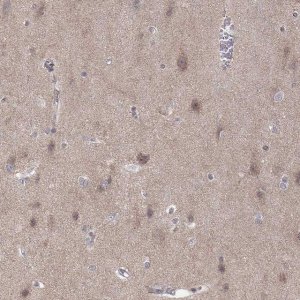 Anti-ABL2 antibody produced in rabbit 