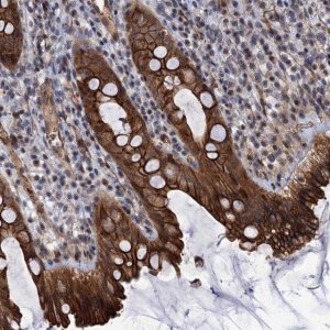 Anti-ABLIM1 antibody produced in rabbit 