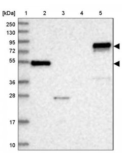 Anti-ABLIM1 antibody produced in rabbit 