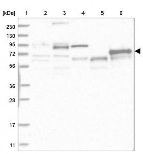 Anti-ABLIM2 antibody produced in rabbit 