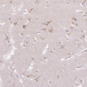 Anti-ABR antibody produced in rabbit HPA054824-100UL