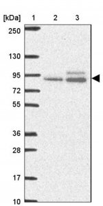 Anti-ABR antibody produced in rabbit HPA054824-100UL