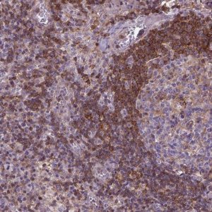 Anti-ACAD10 antibody produced in rabbit 