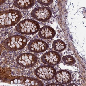 Anti-ACAD8 antibody produced in rabbit 