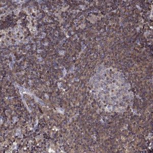 Anti-ACAP1 antibody produced in rabbit 