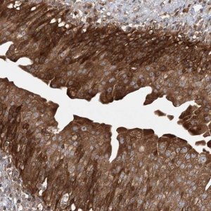 Anti-ACAP2 antibody produced in rabbit 
