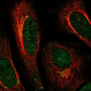 Anti-ACAP3 antibody produced in rabbit 
