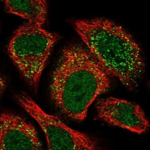 Anti-ACBD4 antibody produced in rabbit 