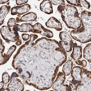 Anti-ACBD6 antibody produced in rabbit 