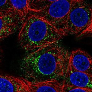 Anti-ACBD7 antibody produced in rabbit 