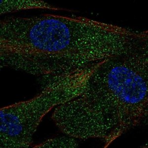 Anti-ACE antibody produced in rabbit 