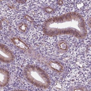 Anti-ACER3 antibody produced in rabbit 