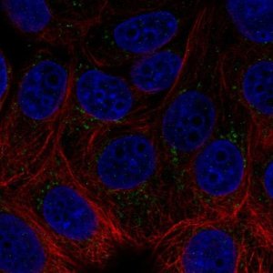 Anti-ACHE antibody produced in rabbit 