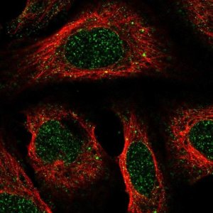 Anti-ACKR2 antibody produced in rabbit 