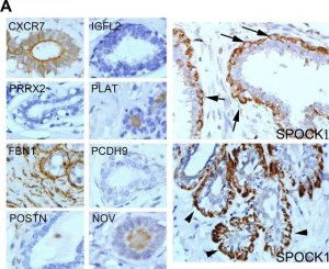 Anti-ACKR3 antibody produced in rabbit 