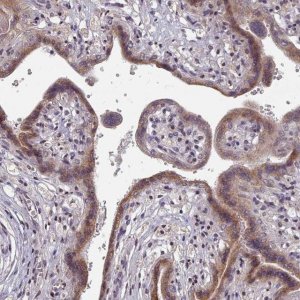 Anti-ACKR3 antibody produced in rabbit 