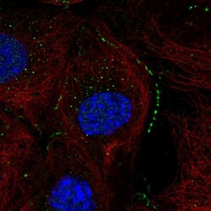 Anti-ACOT13 antibody produced in rabbit HPA019881-100UL