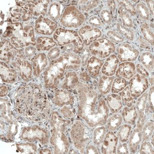 Anti-ACOT4 antibody produced in rabbit 