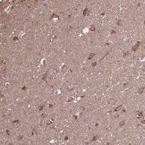 Anti-ACOT6 antibody produced in rabbit 