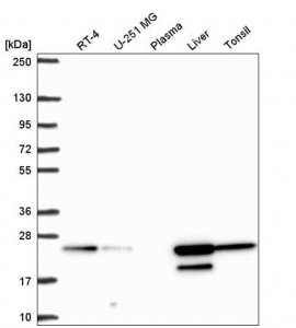 Anti-ACOT6 antibody produced in rabbit 
