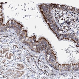 Anti-ACOT9 antibody produced in rabbit 
