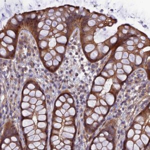 Anti-ADAMTS15 antibody produced in rabbit 
