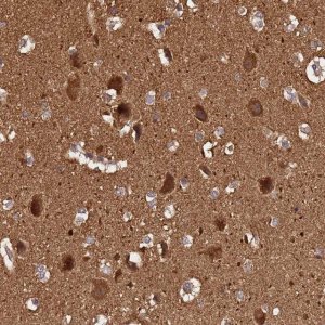 Anti-ADAMTS18 antibody produced in rabbit 