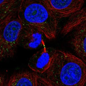 Anti-ADAMTS19 antibody produced in rabbit 