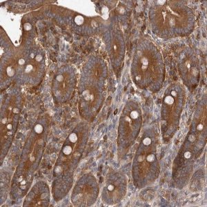 Anti-ADAMTS20 antibody produced in rabbit 
