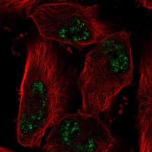 Anti-ADAMTS4 antibody produced in rabbit 