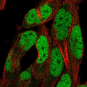 Anti-ADAMTS5 antibody produced in rabbit 