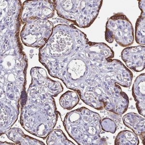 Anti-ADAMTS6 antibody produced in rabbit 