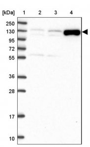 Anti-ADAMTS6 antibody produced in rabbit 