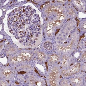 Anti-ADAMTS8 antibody produced in rabbit 
