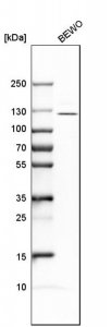 Anti-ADAMTSL4 antibody produced in rabbit 