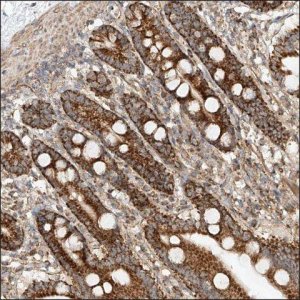 Anti-ADARB2 antibody produced in rabbit HPA031333-100UL