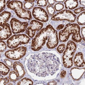 Anti-ADAT1 antibody produced in rabbit 