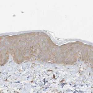 Anti-ADAT2 antibody produced in rabbit 