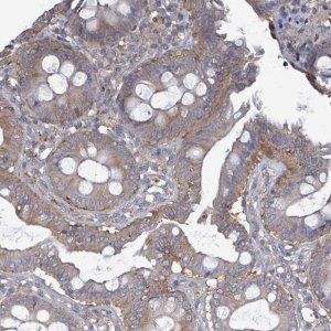 Anti-ADCK1 antibody produced in rabbit 
