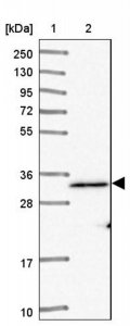Anti-ADCK1 antibody produced in rabbit 
